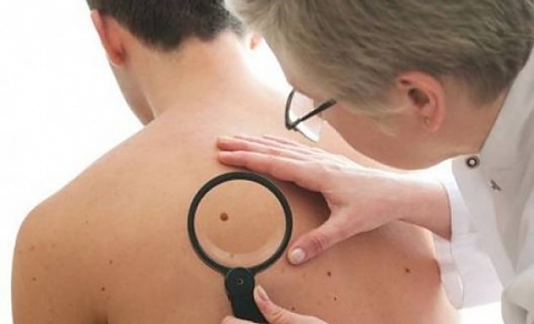 прегледи за рак на кожата