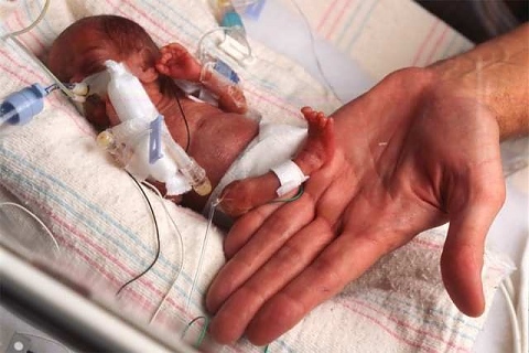 Аборт, раждане, медицински АГ стандарт