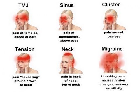 Болки в главата - място и причини