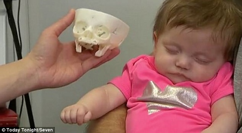 3Д принтиран череп спасява живот