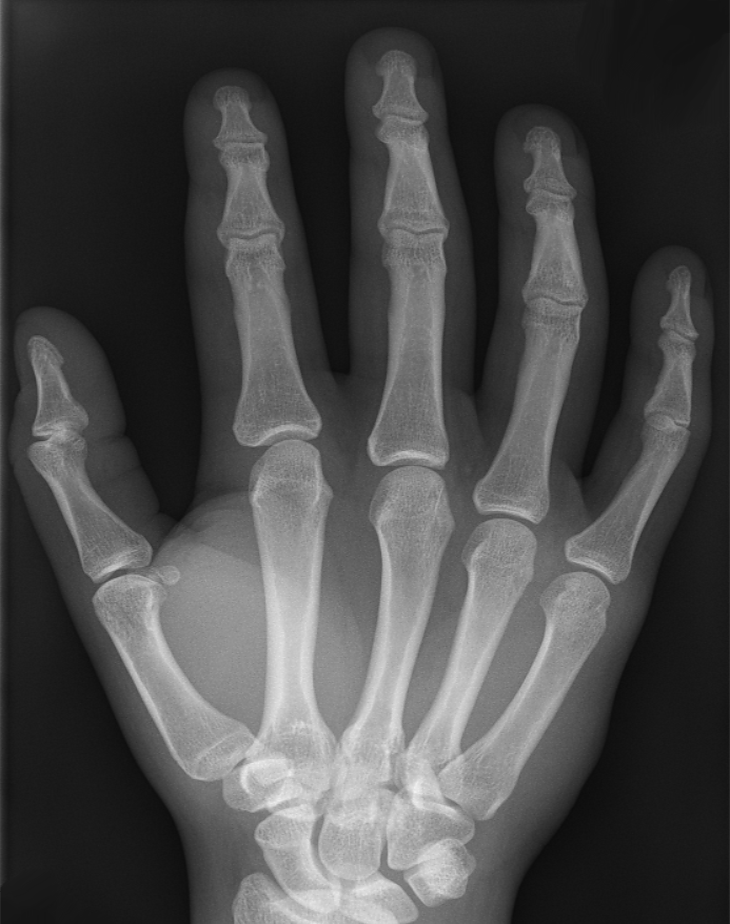 Човешката ръка от върха на пръстите до китката има 27 кости.