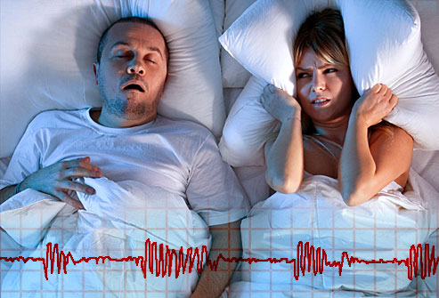 Обструктивна сънна апнея - затруднения с дишането през нощта