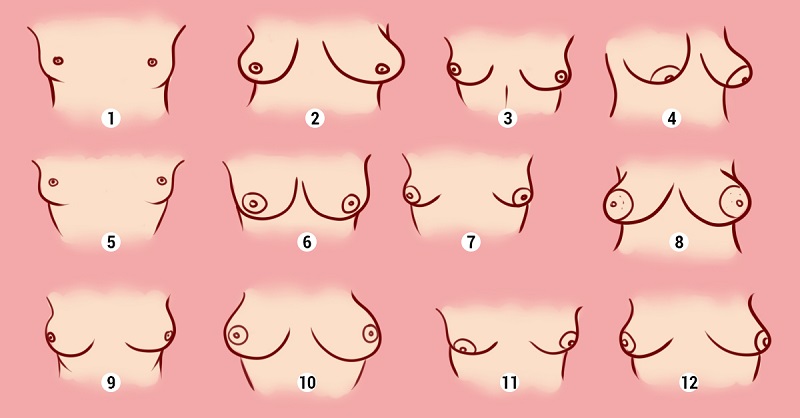 Форма на женските гърди