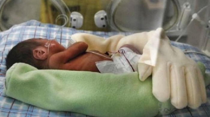 Недоносено бебе с ръкавица