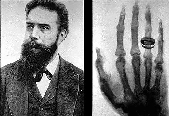 Рьонтген създава рентгеновия апарат