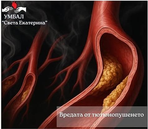 На 31 май светът отбелязва Световния ден без тютюнев дим