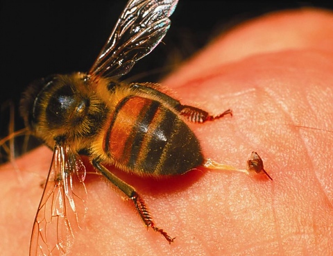 Първа помощ при ужилване от оси и пчели