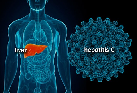 Симптоми на хепатит С, предпазване