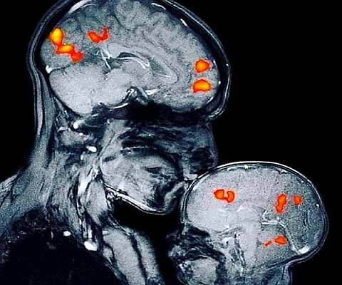 Мозъчните зони, които се задействат при целувка
