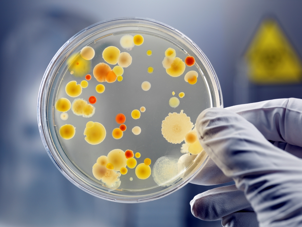 Бактериите са устойчиви на антибиотици