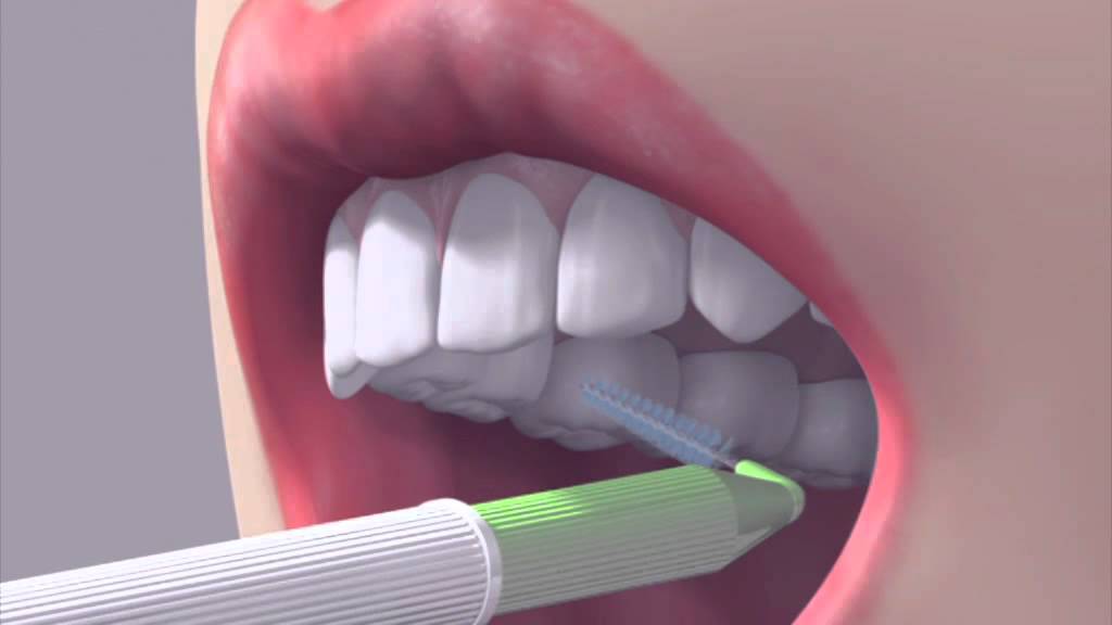 почистване на зъби срещу лош дъх