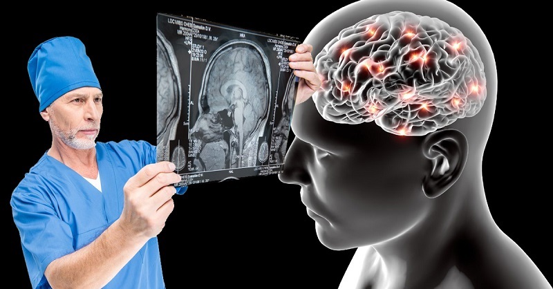 Мозък и интелектуална активност